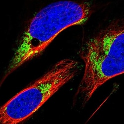 ZFP200 Antibody, Novus Biologicals:Antibodies:Primary Antibodies